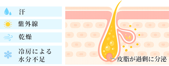夏に毛穴が目立ちやすくなる理由