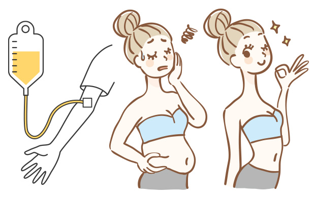 脂肪燃焼・ダイエット点滴